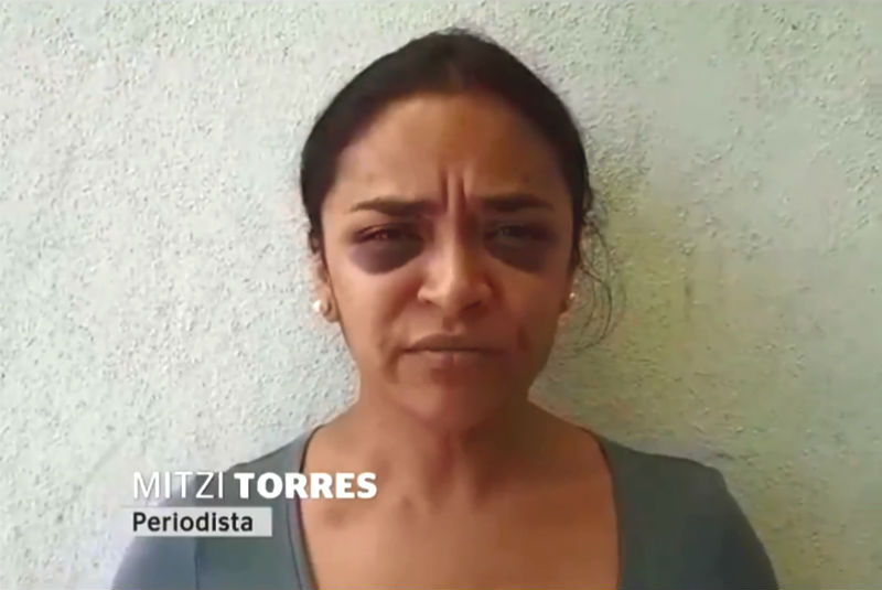  Agresiones a Mitzi Torres ya se investigan en la Comisión de Derechos Humanos