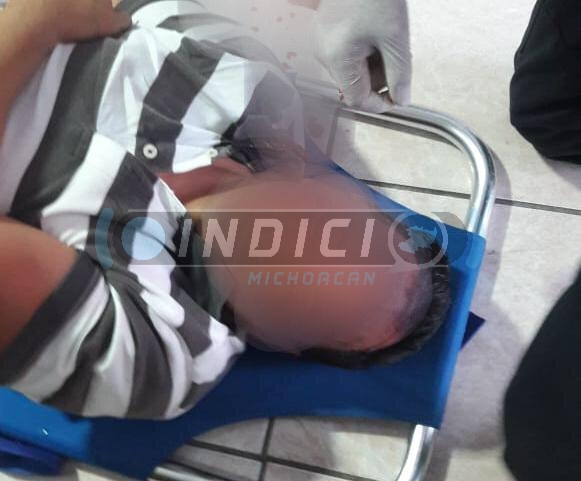  Sujeto gravemente herido tras haber sido baleado en Bucareli