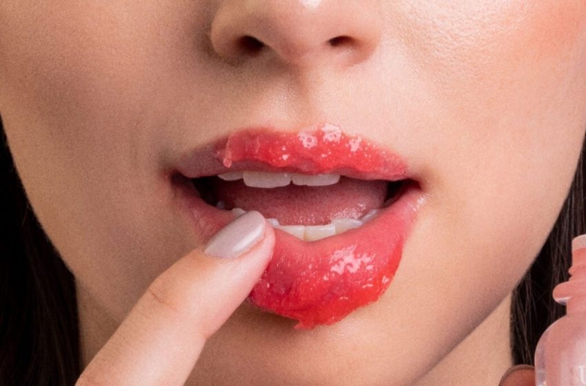  Más Que Una Corona… ¡No más labios resecos!