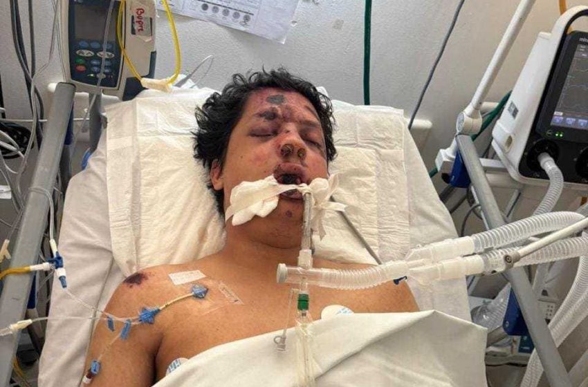Ayuda a localizar a familiares de un joven herido en accidente registrado al norte de Morelia